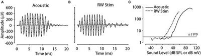 Round Window Stimulation of the Cochlea